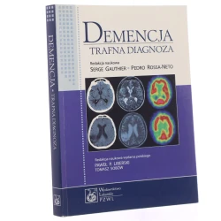 Demencja trafna diagnoza redakcja naukowa Serge Gauthier, Pedro Rosa-Neto tłumaczenie i redakcja naukowa wydania polskiego Paweł P. Liberski redakcja neuropsychologiczna Tomasz Sobów [2021]