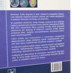 demencja trafna diagnoza (2).JPG